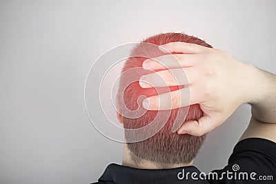 A man suffers from pain in the back of his head. Signs of cervical osteochondrosis, spondylosis, myositis, or hypertension. The Stock Photo