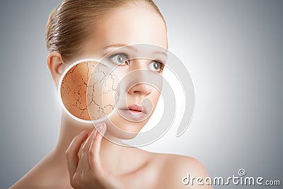 Concept of cosmetic skin care. face of young woman with dry ski Stock Photo