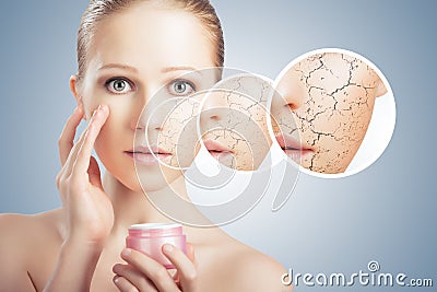 Concept of cosmetic skin care. face of young woman with dry ski Stock Photo