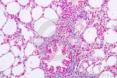 Concept of Education anatomy and Human lung tissue under microscope. Stock Photo