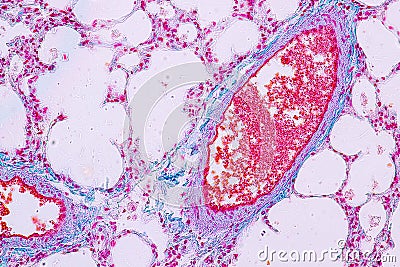 Concept of Education anatomy and Human lung tissue under microscope. Stock Photo