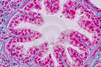 Concept of Education anatomy and Human lung tissue under microscope. Stock Photo