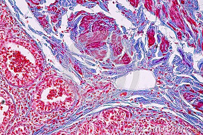 Concept of Education anatomy and physiology of mammary gland is an exocrine gland in mammals under the microscopic . Stock Photo
