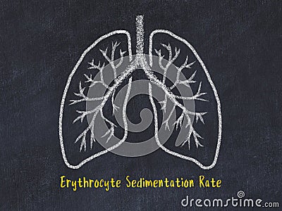 Concept of learning lung diseases. Chalk drawing of lungs with inscription Stock Photo