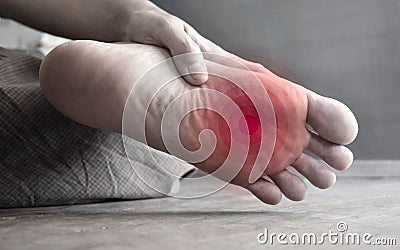 Concept of nail prick and cellulitis in foot of Asian man. Sensory neuropathy problems. Foot nerves problems. Plantar fasciitis Stock Photo