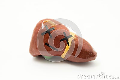 Concept photo of death as organ, deadly incurable disease or liver failure function. Anatomical figure liver with emotion dead smi Stock Photo