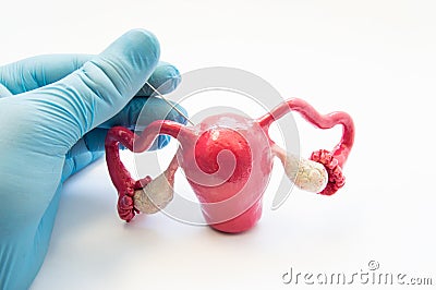 Concept photo of gynecological surgical procedure of biopsy female reproductive organs and tissues - uterine, endometrium or ovari Stock Photo