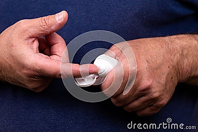 Concept photo of treatment of skin diseases using ointments as dosage form of drug. Patient causes medical therapeutic ointment Stock Photo