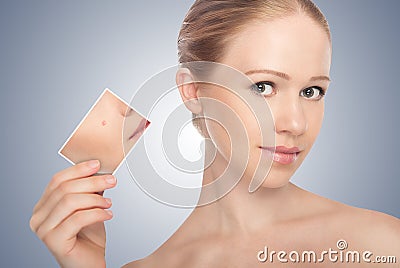 Concept skincare . Skin of beautywoman Stock Photo