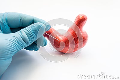 Concept of stomach puncture or gastrointestinal perforation. Hand of surgeon pierces wall of model of human stomach for therapeut Stock Photo