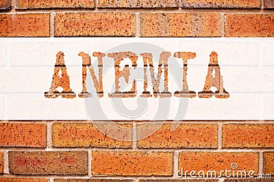 Conceptual announcement text caption inspiration showing Anemia. Business concept for Medical Diagnosis Iron deficiency aplastic w Stock Photo