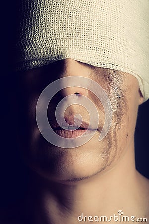 Conceptual photo of a hurt woman crying with bandage around her head Stock Photo