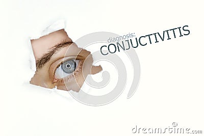 Conjuctivitis disease poster with blue eye on left Stock Photo