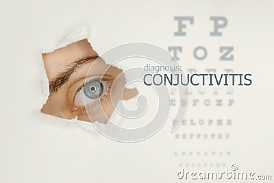 Conjuctivitis disease poster with eye test chart and blue eye on right Stock Photo