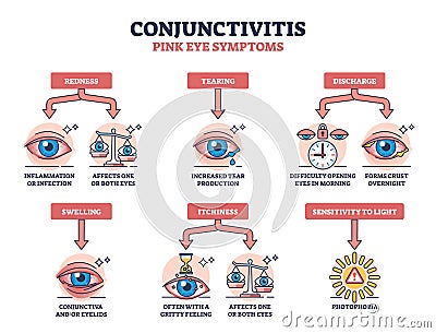 Conjunctivitis or pink eye symptoms with medical examples outline diagram Vector Illustration