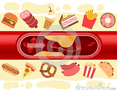 Consequences of fast food. Blood vessel with cholesterol plaque. Harmful nutrition. Atherosclerosis disease. Artery Vector Illustration