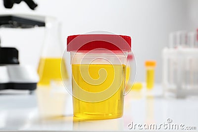 Container with urine sample for analysis on table Stock Photo