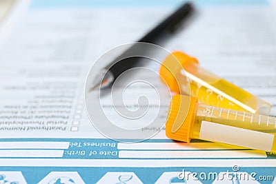 Containers with urine samples for analysis on medical report, closeup. Stock Photo