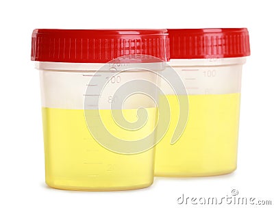 Containers with urine samples for analysis on white background Stock Photo