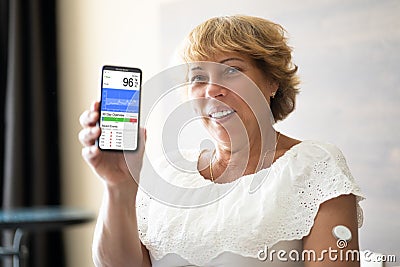 Continuous Blood Sugar Level Measuring Device Stock Photo