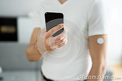 Continuous Glucose Monitor Blood Sugar Test Stock Photo
