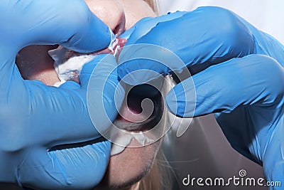 Contour plastic: Dermatologist performs lips massage after the c Stock Photo