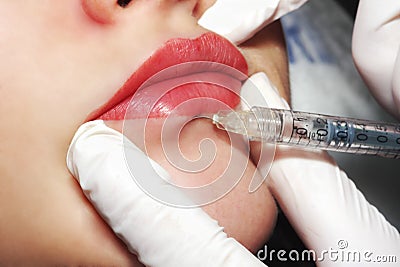 Contour plastic: Injection of filler Stock Photo