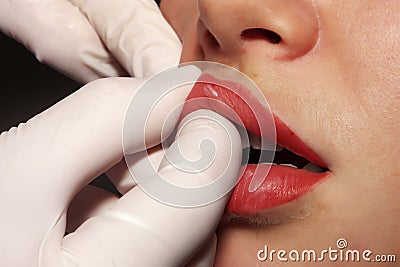 Contour plastic: Lips massage after the contour plastic Stock Photo