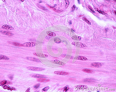 Contracted smooth muscle fibers Stock Photo