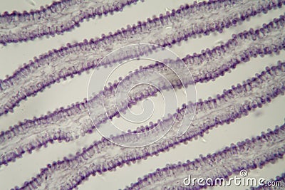 Coprinus mushroom under the microscope Stock Photo