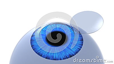 Corneal flap eye illustration. Isolated on white. 3D-rendering. Cartoon Illustration