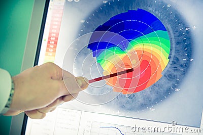 Corneal topography Stock Photo