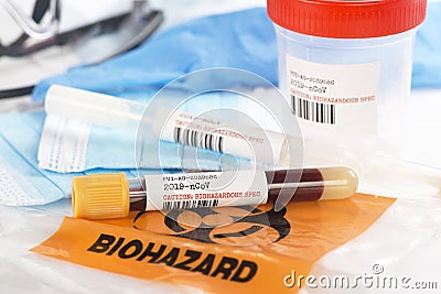 Corona 2019-nCoV Virus Blood, Sputum And Specimen Tests With Gloves, Masks Stock Photo