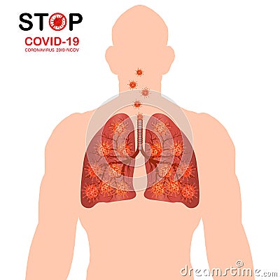 Coronavirus disease COVID-19 infection medical illustration. China pathogen respiratory influenza covid virus cells. Body heat Vector Illustration