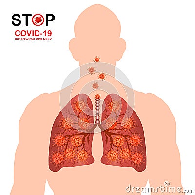 Coronavirus disease COVID-19 infection medical illustration. China pathogen respiratory influenza covid virus cells. Body heat Cartoon Illustration