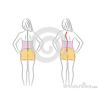 Correct alignment of human body in standing posture for good personality and healthy of spine and bone. Health care and medical il Vector Illustration