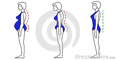 Correct Posture Vector Illustration