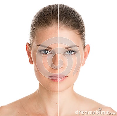 Before and after cosmetic operation Stock Photo