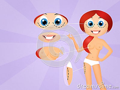 Cosmetic surgery Cartoon Illustration