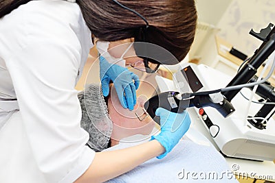 cosmetologist uses a CO2 fractional ablative laser to rejuvenate the skin and remove scars in a modern cosmetic beauty Stock Photo