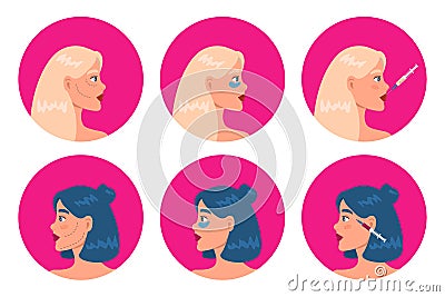 Cosmetology procedure set beauty injection, plastic surgery, lip fillers, hyaluronic acid, eye patches, face mask. Vector Illustration