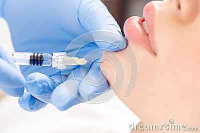 Cosmetology Service. Young woman at beauty clinic lying while doctor in gloves doing injection of collagen touching skin Stock Photo