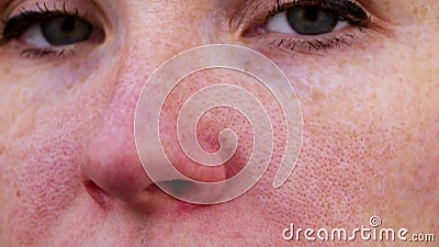Couperose sul naso di giovane ragazza attraente Concetto capillare di trattamento della maglia Acne sul fronte Esame da un medico stock footage Couperose sul naso di giovane ragazza attraente Concetto capillare di trattamento della maglia Acne sul fronte Esame da un medico stock footage