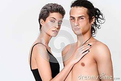 Couple woman and man Vitiligo skin problems portrait. Unusual pe Stock Photo
