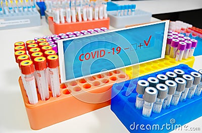 Covid-19. An infected Covid-19 sample in a test tube with a label in the doctor`s hand. Laboratory tube with SARS-CoV2. Laborator Stock Photo