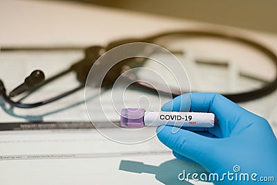 COVID-19 laboratory blood test,coronavirus background concept Stock Photo