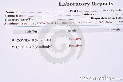 COVID-19 positive results by using RT-PCR and rapid test antibody method Stock Photo