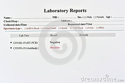 COVID-19 negative and positive test results Stock Photo