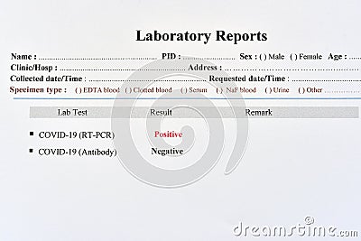 COVID-19 negative and positive test results Stock Photo