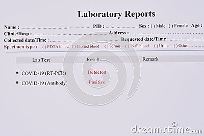 COVID-19 test results by using RT-PCR method and rapid test antibody method Stock Photo